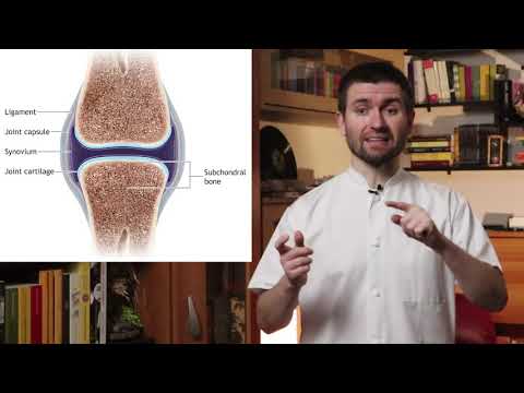 Osteoartrita 3 grade ale articulației genunchiului