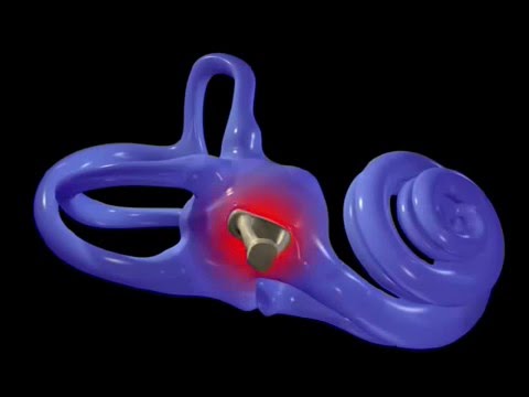 O Funcionamento do ouvido humano   auditory transduction em português