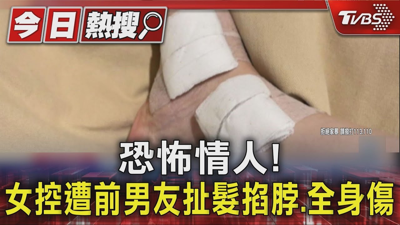 獨/女控遭前男友扯髮撞牆掐脖 全身傷分手後竟被討4萬卡費