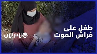 "أم تطالب مساعدة صغيرها المصاب بمرض" تاي ساكس" القاتل .. "قالو ليا خمس سنين وغادي يموت thumbnail