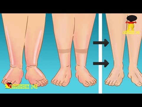 Es unterscheidet sich von vitaprost vitaprost Plus Wie hoch ist die Prostatitis