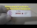 Malaria Rapid Test Positive Demonstration