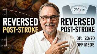 I Lost 85 lbs After a Stroke — How I Did It