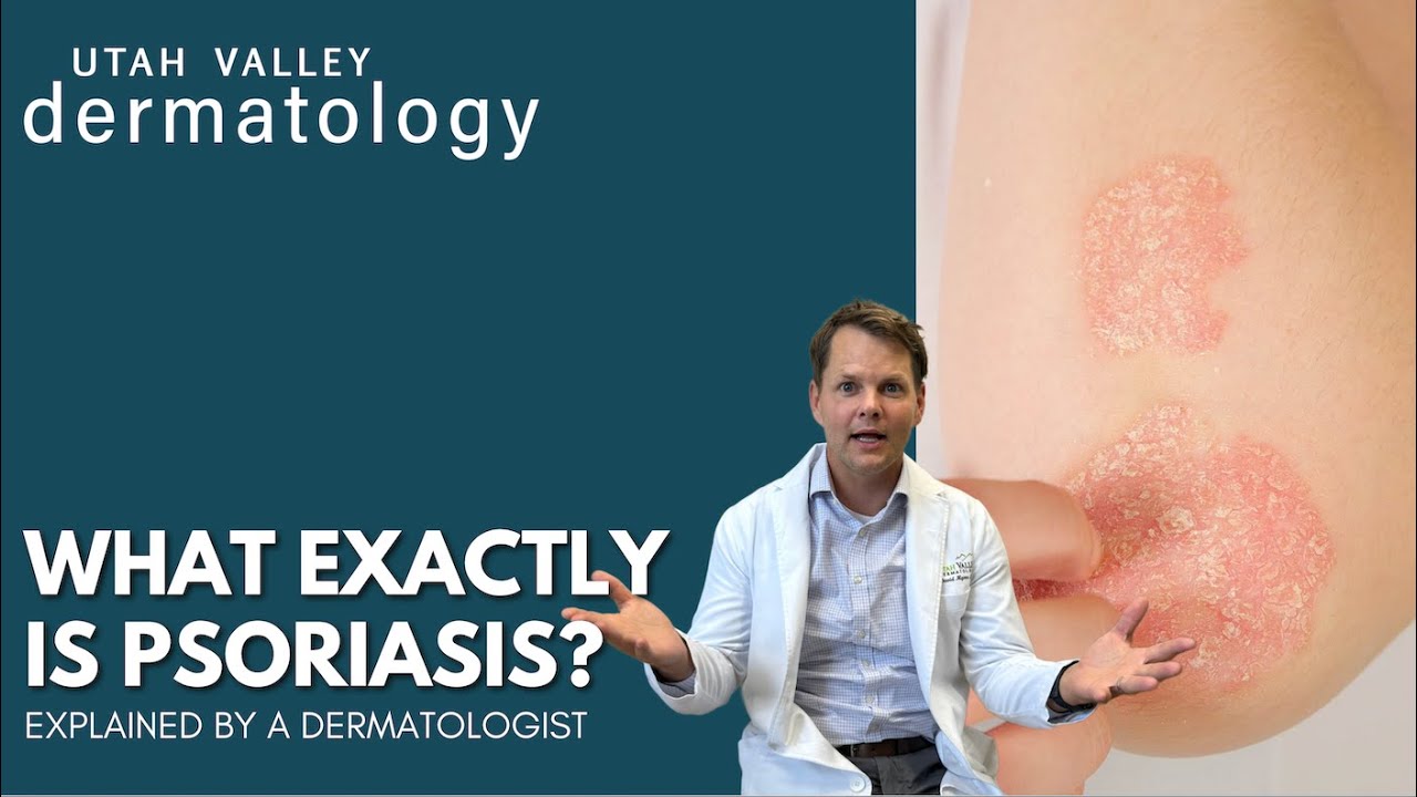 What Exactly IS Psoriasis? | Utah Valley Dermatology