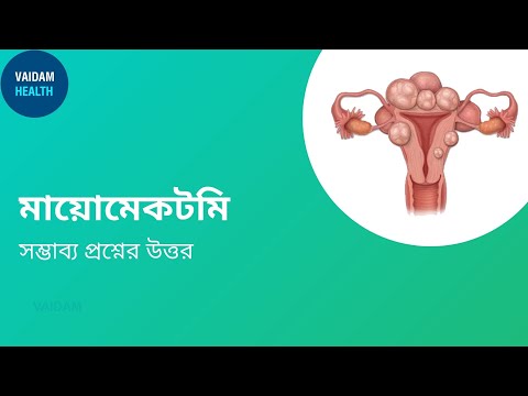 মায়োমেক্টমি -প্রায়শই জিজ্ঞাসিত প্রশ্ন