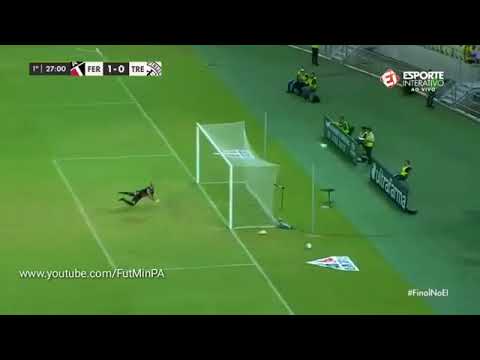 Ferroviário 3 x 0 Treze PB HD   Gols  Melhores Mom360P