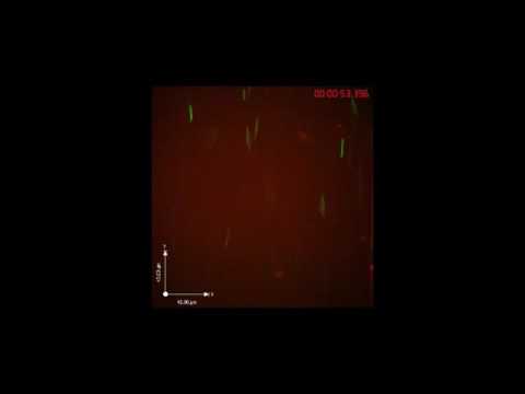 Lyme disease pathogen interacting with human endothelia in flow chamber mimicking blood vessels Video