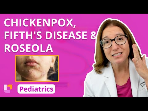 Chickenpox, Fifth's Disease, & Roseola: Alterations in Health - Pediatric Nursing | @LevelUpRN