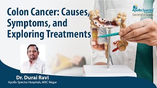 Colon Cancer: Causes, Symptoms & Treatments by Dr. Durai Ravi, Apollo Spectra Hospitals