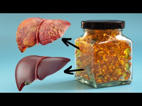 1 kapsula dnevno...uklanja MASNOĆE sa JETRE!