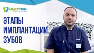 Этапы имплантации зубов. 😷 Операция по установке импланта за один день.