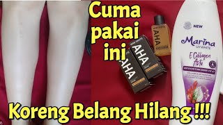 Download lagu PERMANENT BODY WHITENING LOTION / QUICK WAY TO WHITE UNDISTANT SKIN / MIMI WHITE AHA AND MARINA mp3