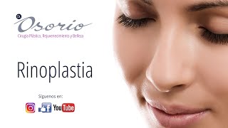 En vivo - Rinoplastia.