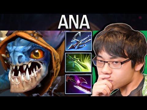 Slark Dota 2 Gameplay Ana with 28 Kills and 900 GPM