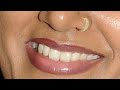 Actress Devadarshani Beautiful Lips And Face Closeup Ultra Zoom