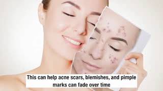 Remedies To Get Rid Of Red Acne Marks | Acne Care