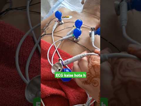 ECG kaise hota h #nursingofficer #hospital #nursing #mbbs #doctor #patientcare