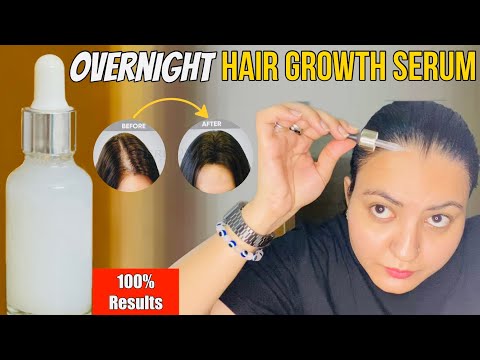 DIY Thick Hair Growth Serum : Get Thick Hair Growth, Double Density👍🏻 Grow Hairline, Bald Patches❤️