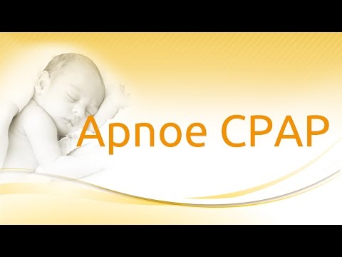 medinCNO ventilation modes: Apnea CPAP