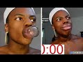 Ishowspeed Tries The Kylie Jenner Lip Challenge