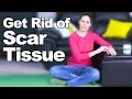 Get Rid Of Scar Tissue Ask Doctor Jo