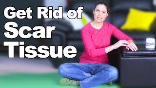 Get Rid of Scar Tissue - Ask Doctor Jo