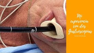 Mi experiencia con dos gastroscopias