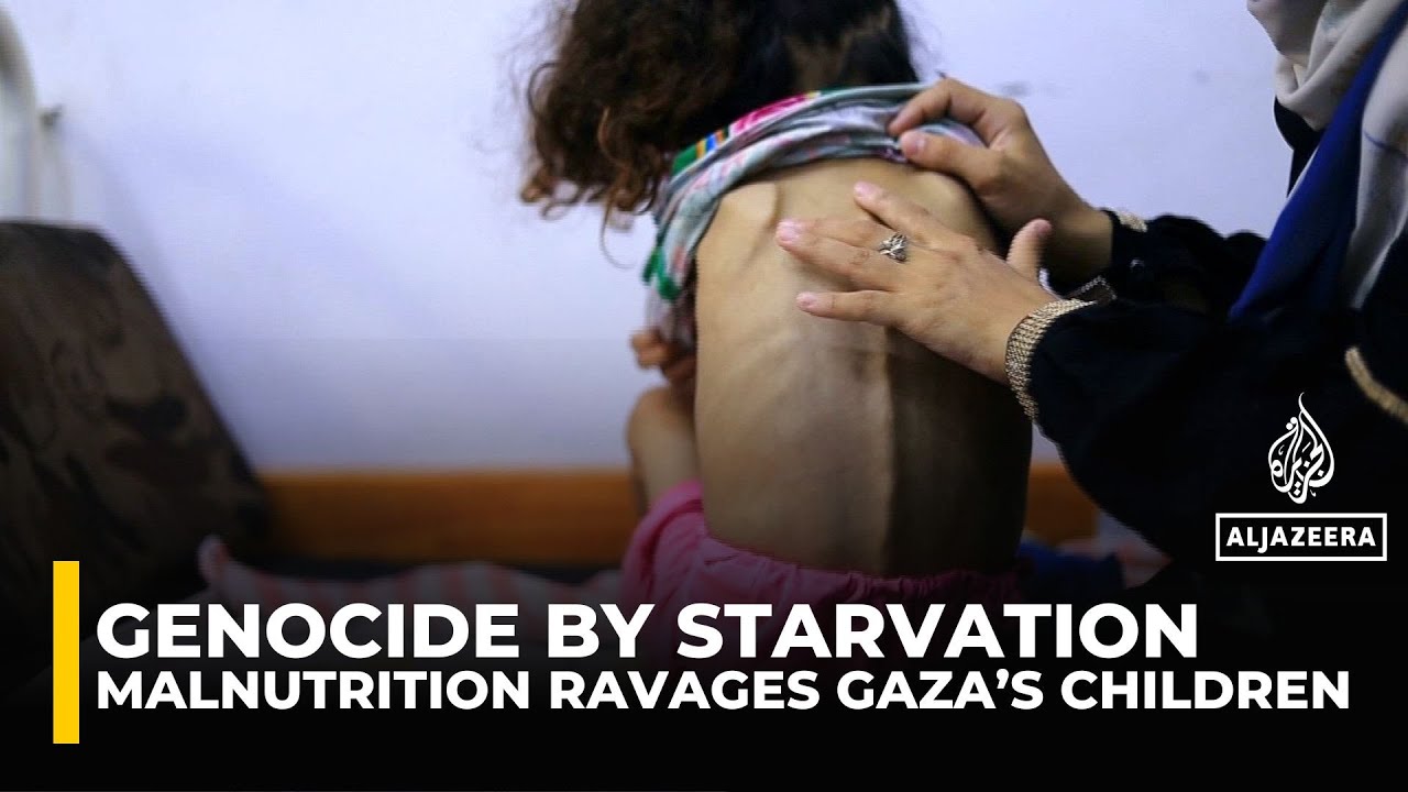 Severe malnutrition grips Gaza’s children as blockade seals borders