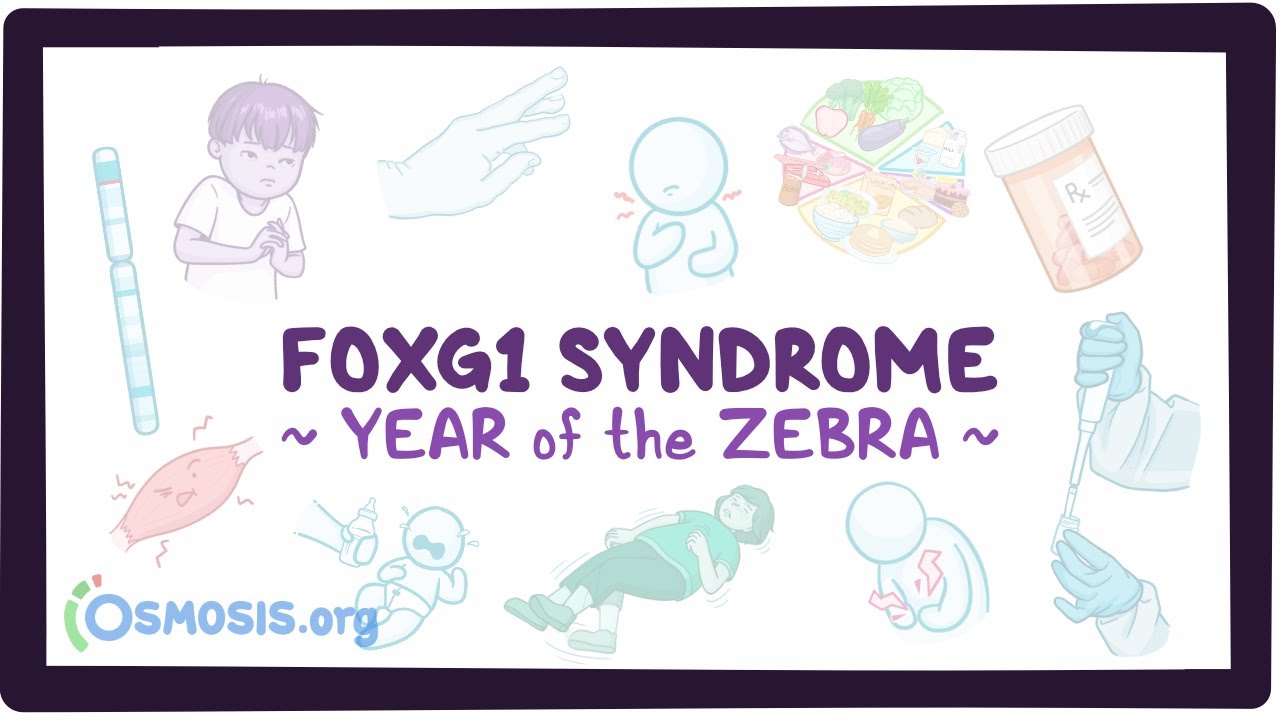 FOXG1 syndrome (Year of the Zebra)