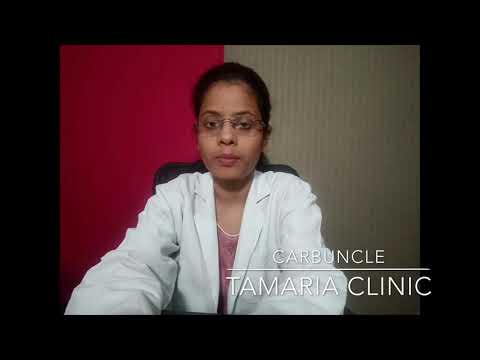 Homeopathic treatment of carbuncle!!