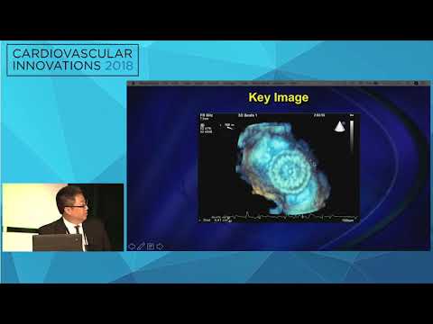 CVI2018 Session: Imaging got us out of this trouble - Richard Bae, MD