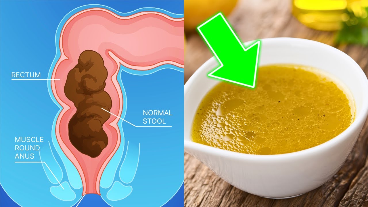 1 tbsp every morning and you won't regret what happens next