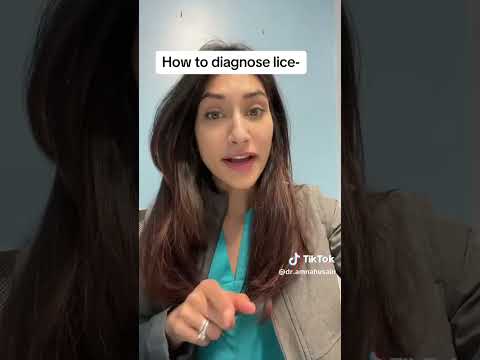 How to Diagnose Lice | Dr. Amna Husain #shorts #lice