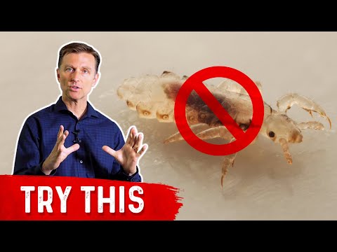 Shingles Natural Relief