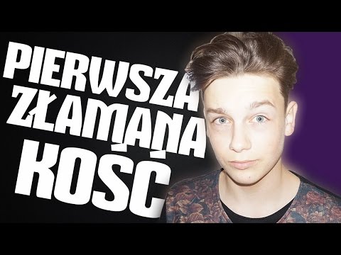 Deformacja stopy po złamaniu Powodowania deformacji palucha