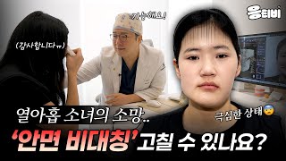 열아홉 소녀의 소망🙏 '안면 비대칭', 정말 고칠 수 있나요? (Part.1)｜새로운삶의시작｜임종우 원장