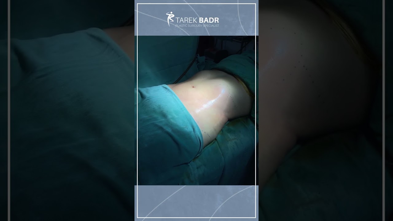 النتيجة الأفضل لشكل الجسم