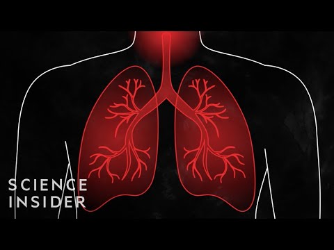 冠狀病毒如何影響糖尿病、癌症和其他病症的患者 (How Coronavirus Affects People With Diabetes, Cancer, And Other Conditions)