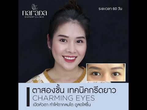 สร้างชั้นตาสวยมีเสน่ห์ ด้วยการทำตา2ชั้น เทคนิคกรีดยาว ที่ นารดาคลินิก