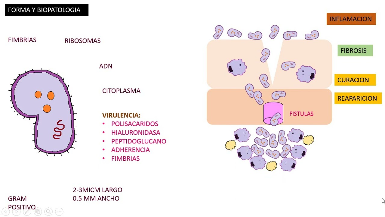 Actinomicosis, Actinomyces Israelii
