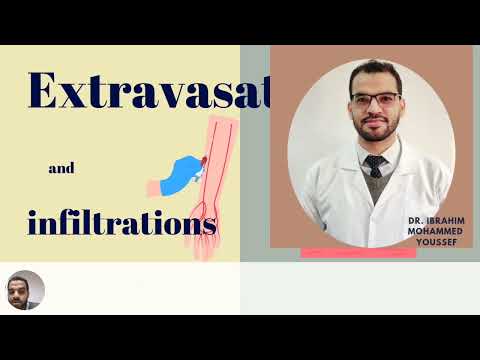 Extravasation vs. infiltration for nurses