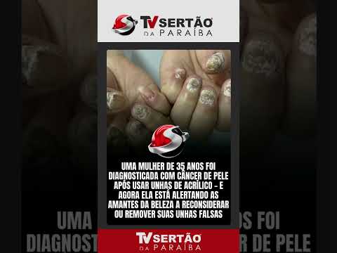 Alerta de saúde: Lâmpadas UV para unhas de gel podem causar câncer de pele?