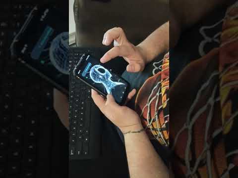 Doogee S96 Pro problem