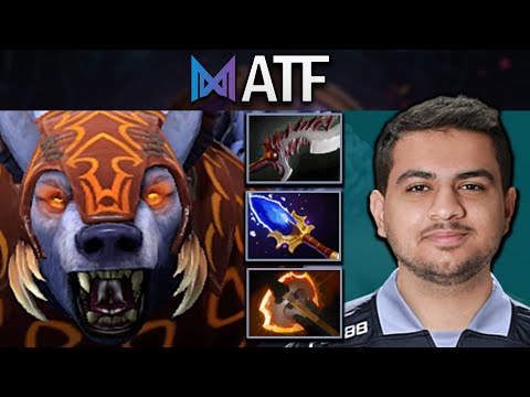 Ursa Dota 2 Gameplay Nigma.ATF with Battlefury - Aghanims