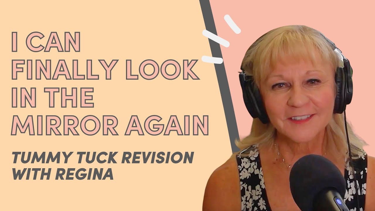 I Can Finally Look in the Mirror Again: Regina’s Tummy Tuck Revision Experience