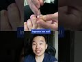 Ingrown Toe Nail Shorts