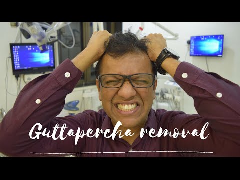 Gutta-percha Removal | Easy technique to remove gutta-percha in retreatment cases
