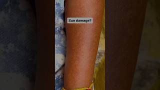 Download lagu Sun damage? Try this! #shorts #deadskin #youtube #beautyhacks mp3