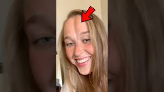 Download lagu Butt Forehead mp3