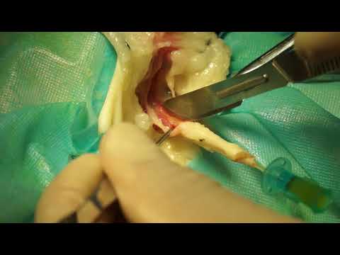 Urethrostomy of the male cats （surgery）